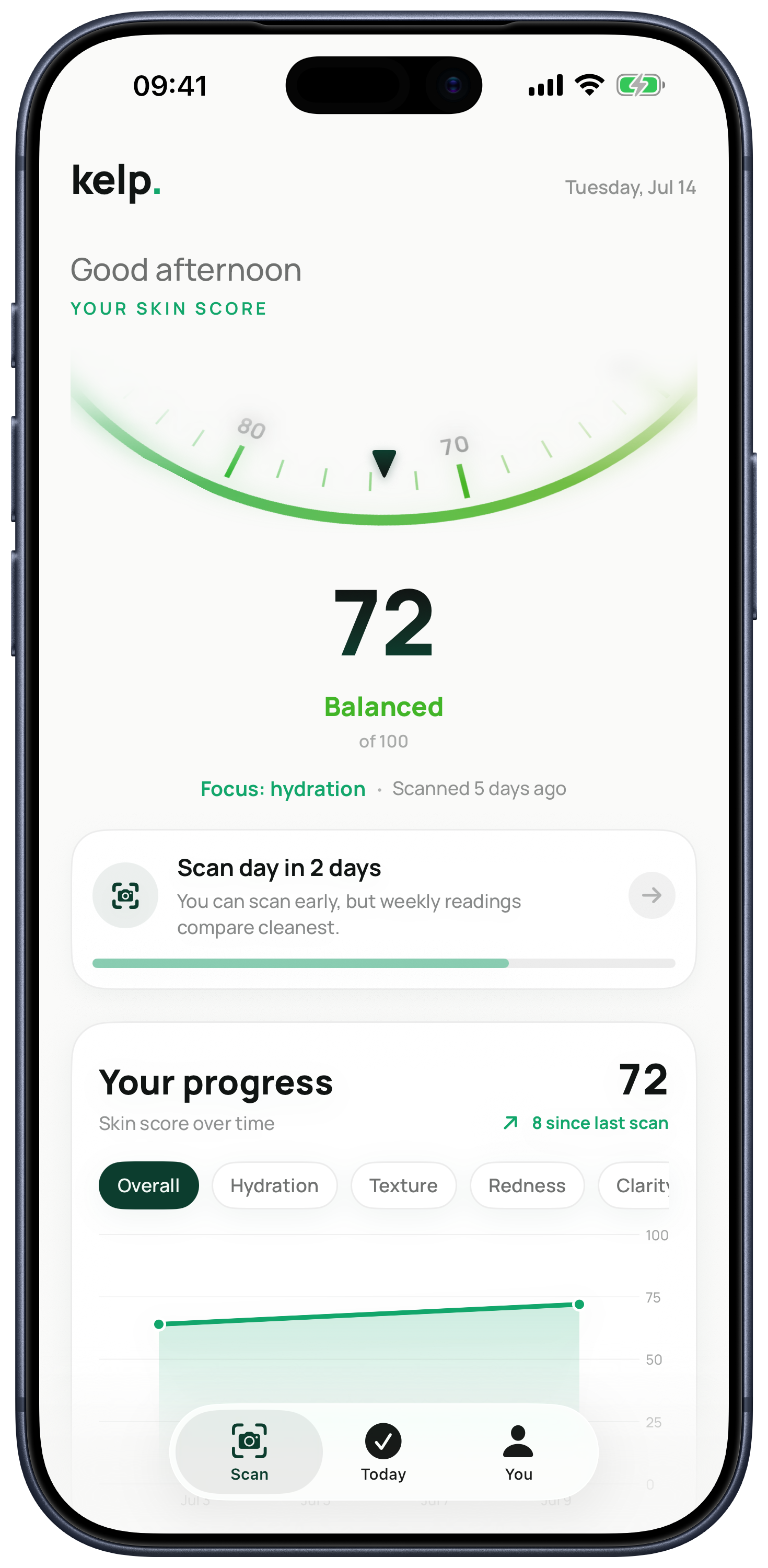 Kelp home screen displayed in an iPhone 17 Pro Max, showing a skin score of 72, weekly scan timing, and progress chart